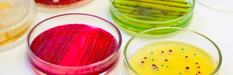 ANALYSES MICROBIOLOGIQUES EN ALIMENTAIRE