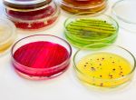 ANALYSES MICROBIOLOGIQUES EN ALIMENTAIRE